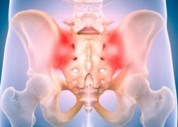 Já ouviu falar da dor sacro ilíaca, também conhecida como a “dor esquecida”?