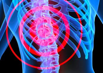 Mitos e Verdades sobre Cirurgia da Coluna Vertebral