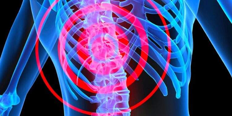 Mitos e Verdades sobre Cirurgia da Coluna Vertebral