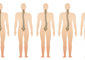Desvios de Coluna:  Entendendo as Causas, Sintomas e Tratamentos