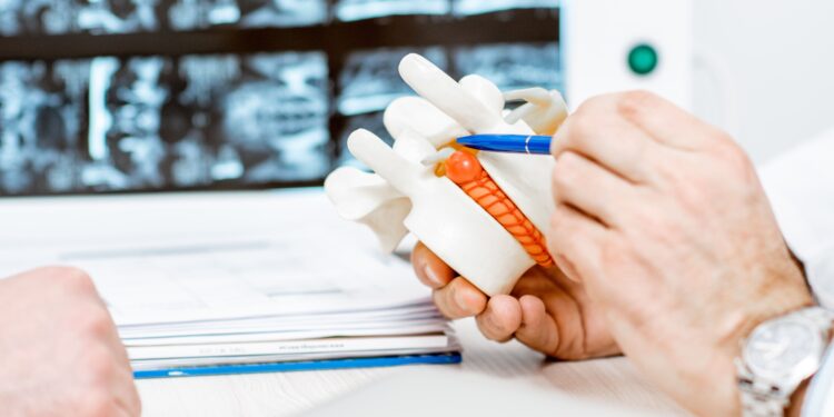 Porque a hérnia de disco é o problema de coluna mais comum na população brasileira?