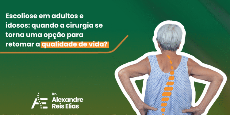 Escoliose em adultos e idosos: quando a cirurgia se torna uma opção para retomar a qualidade de vida?