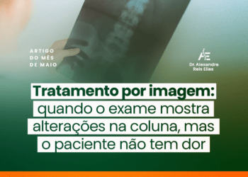 Tratamento por imagem: quando o exame mostra alterações na coluna, mas o paciente não tem dor