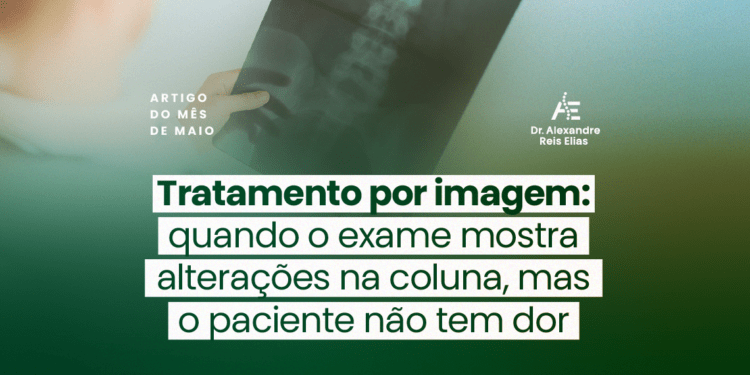 Tratamento por imagem: quando o exame mostra alterações na coluna, mas o paciente não tem dor