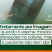 Tratamento por imagem: quando o exame mostra alterações na coluna, mas o paciente não tem dor