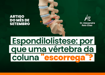 Espondilolistese: por que uma vértebra da coluna “escorrega”?