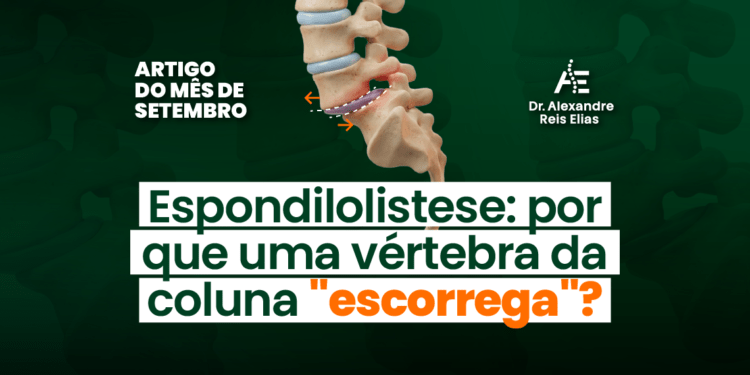 Espondilolistese: por que uma vértebra da coluna “escorrega”?
